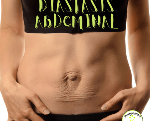Diástasis abdominal
