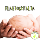 Fisioterapia en plagiocefalia
