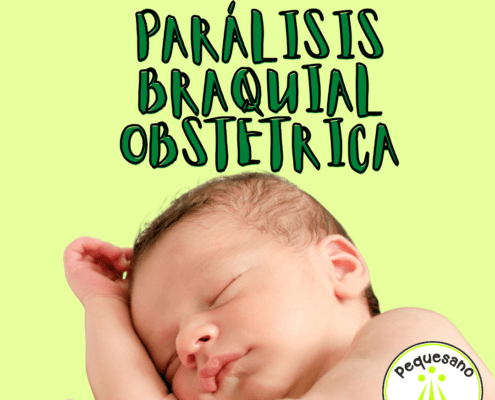 parálisis braquial obstétrica