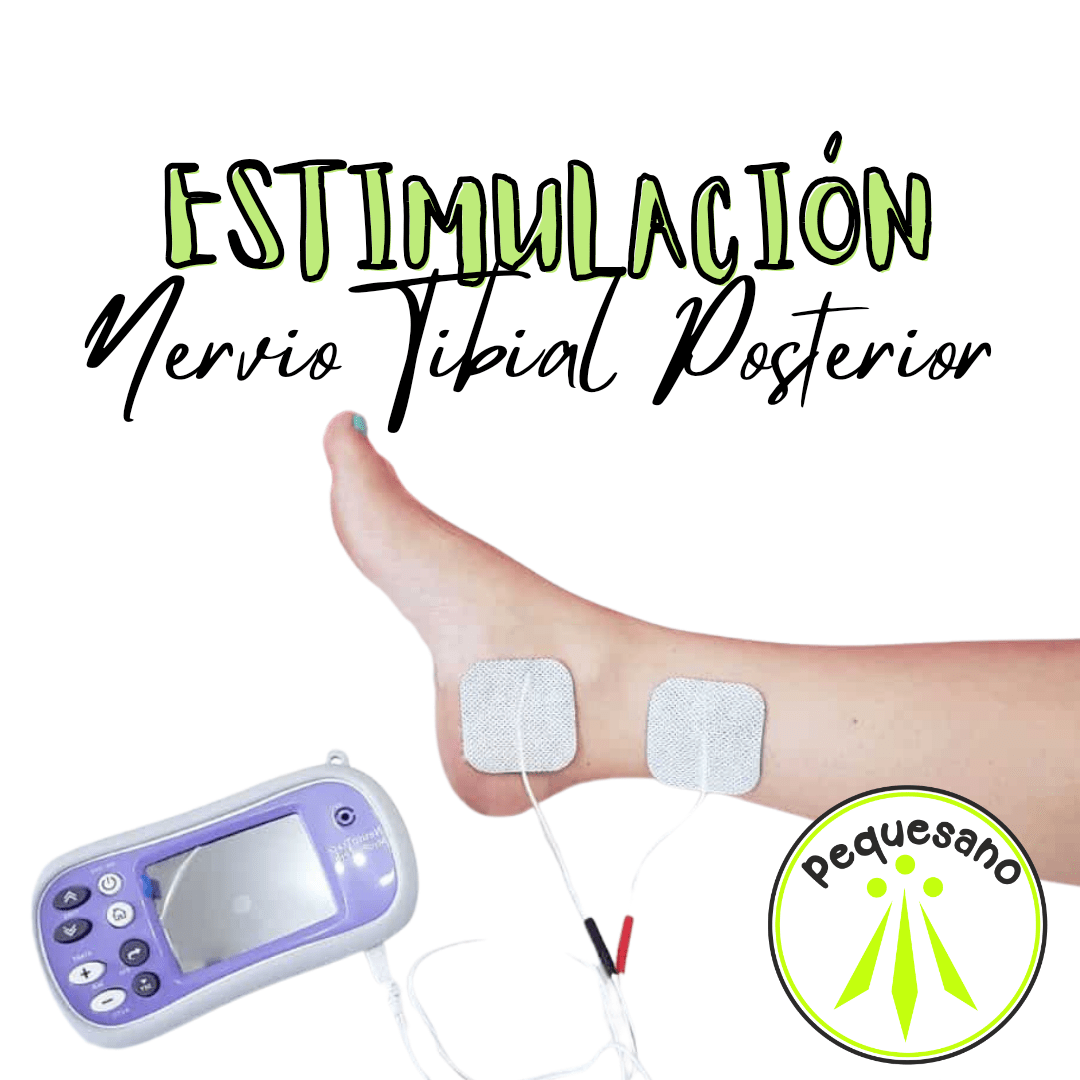 Neuromodulaci n Tibial Posterior